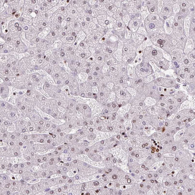 FUS Antibody (CL0190) - Azide and BSA Free Immunohistochemistry-Paraffin: FUS Antibody [NBP3-44055]