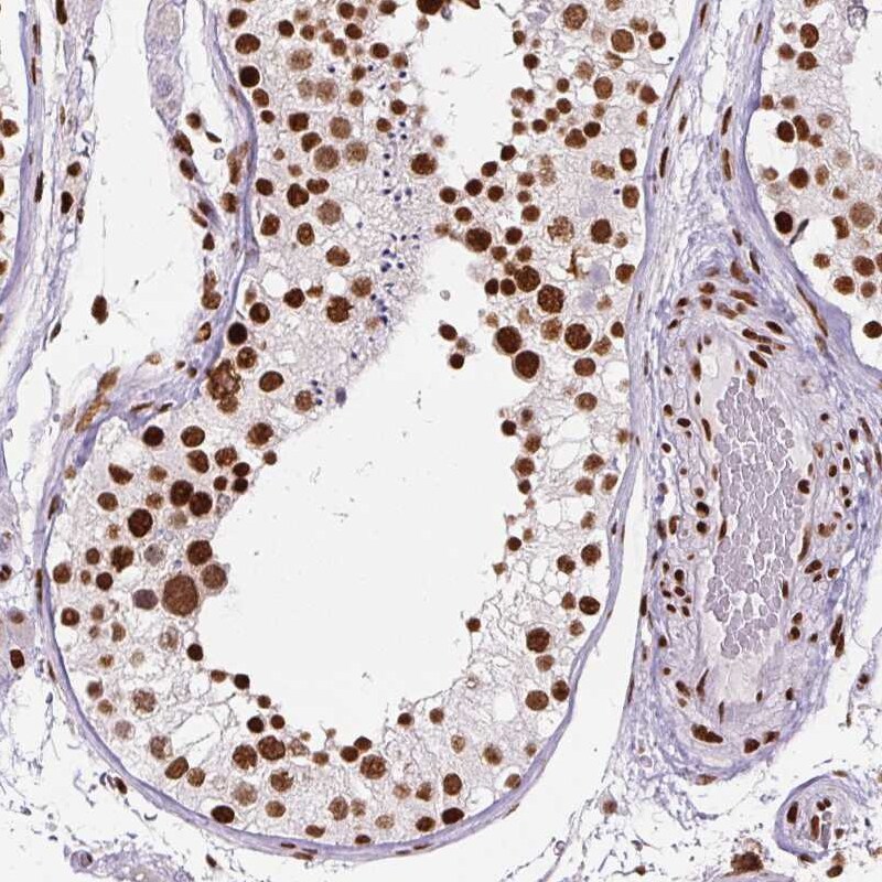FUS Antibody (CL0190) - Azide and BSA Free Immunohistochemistry-Paraffin: FUS Antibody [NBP3-44055]