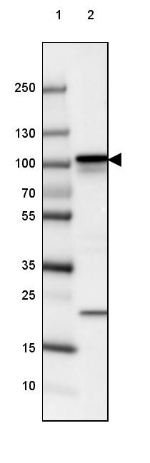 beta-Catenin Antibody (CL3689) - Azide and BSA Free Western Blot: beta-Catenin Antibody [NBP3-44056]