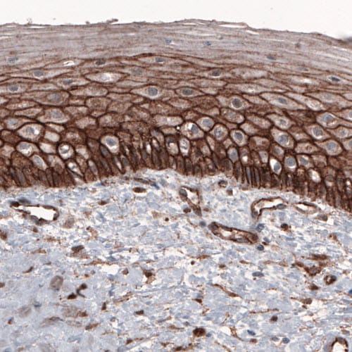 beta-Catenin Antibody (CL3689) - Azide and BSA Free Immunohistochemistry-Paraffin: beta-Catenin Antibody [NBP3-44056]