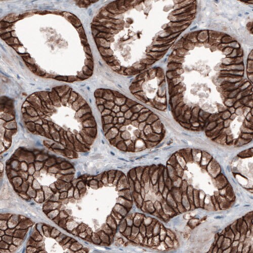 beta-Catenin Antibody (CL3689) - Azide and BSA Free Immunohistochemistry-Paraffin: beta-Catenin Antibody [NBP3-44056]