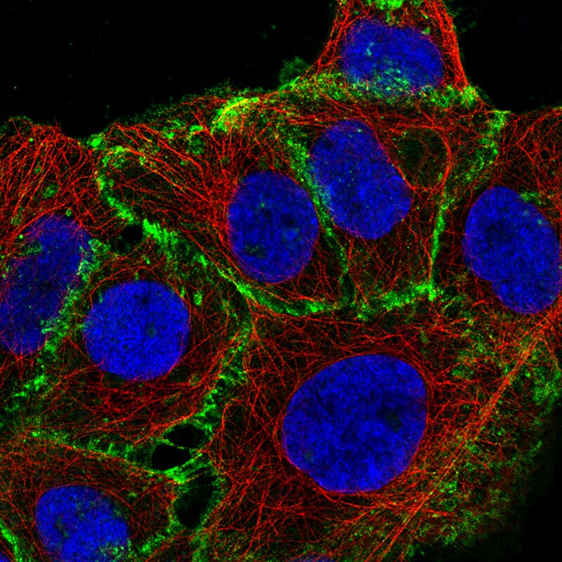 beta-Catenin Antibody (CL3691) - Azide and BSA Free Immunocytochemistry/ Immunofluorescence: beta-Catenin Antibody [NBP3-44057]
