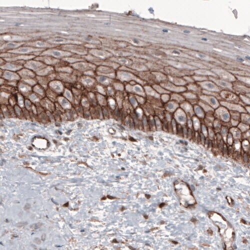 beta-Catenin Antibody (CL3691) - Azide and BSA Free Immunohistochemistry-Paraffin: beta-Catenin Antibody [NBP3-44057]