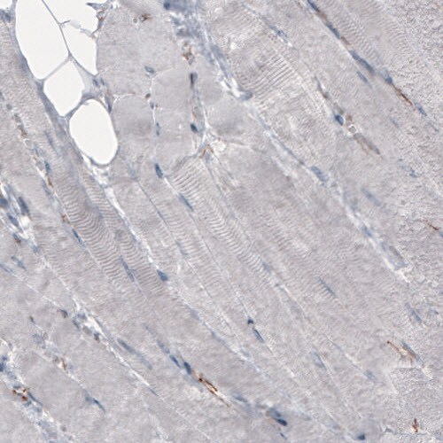beta-Catenin Antibody (CL3691) - Azide and BSA Free Immunohistochemistry-Paraffin: beta-Catenin Antibody [NBP3-44057]