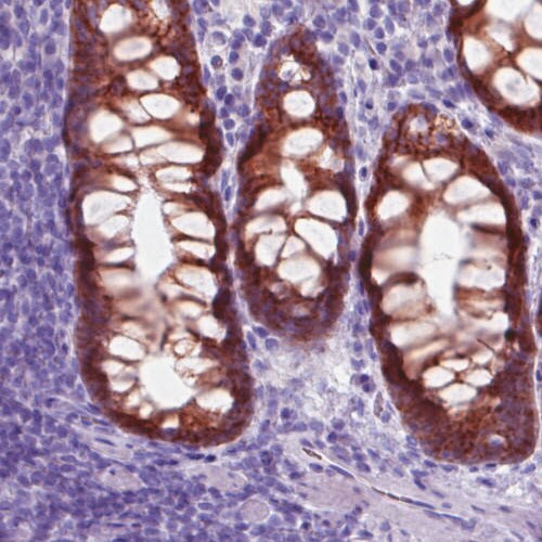 Carbonic Anhydrase XII/CA12 Antibody (CL0280) - Azide and BSA Free Immunohistochemistry-Paraffin: Carbonic Anhydrase XII/CA12 Antibody [NBP3-44059]