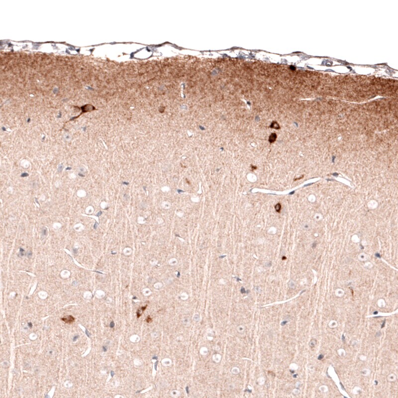 Reelin Antibody (CL5324) - Azide and BSA Free Immunohistochemistry-Paraffin: Reelin Antibody [NBP3-44060]