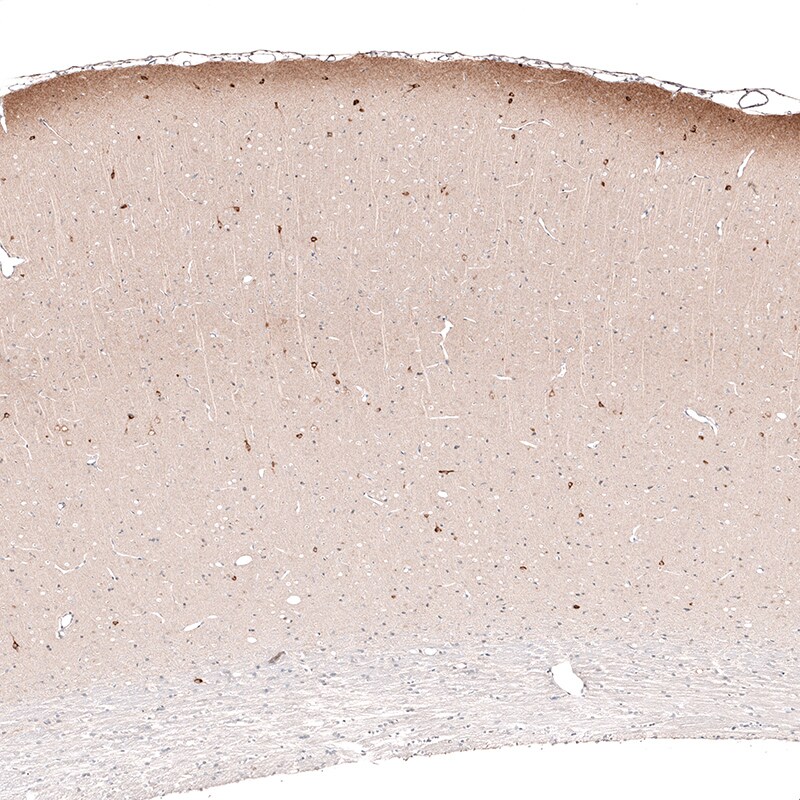 Reelin Antibody (CL5324) - Azide and BSA Free Immunohistochemistry-Paraffin: Reelin Antibody [NBP3-44060]