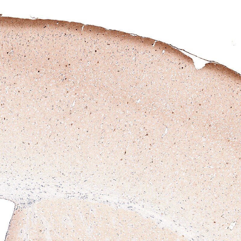 Reelin Antibody (CL5324) - Azide and BSA Free Immunohistochemistry-Paraffin: Reelin Antibody [NBP3-44060]
