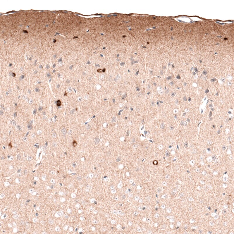 Reelin Antibody (CL5324) - Azide and BSA Free Immunohistochemistry-Paraffin: Reelin Antibody [NBP3-44060]