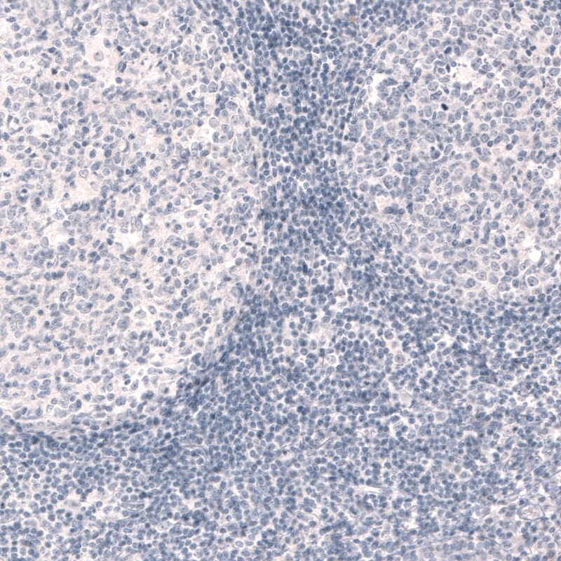 Reelin Antibody (CL5324) - Azide and BSA Free Immunohistochemistry-Paraffin: Reelin Antibody [NBP3-44060]
