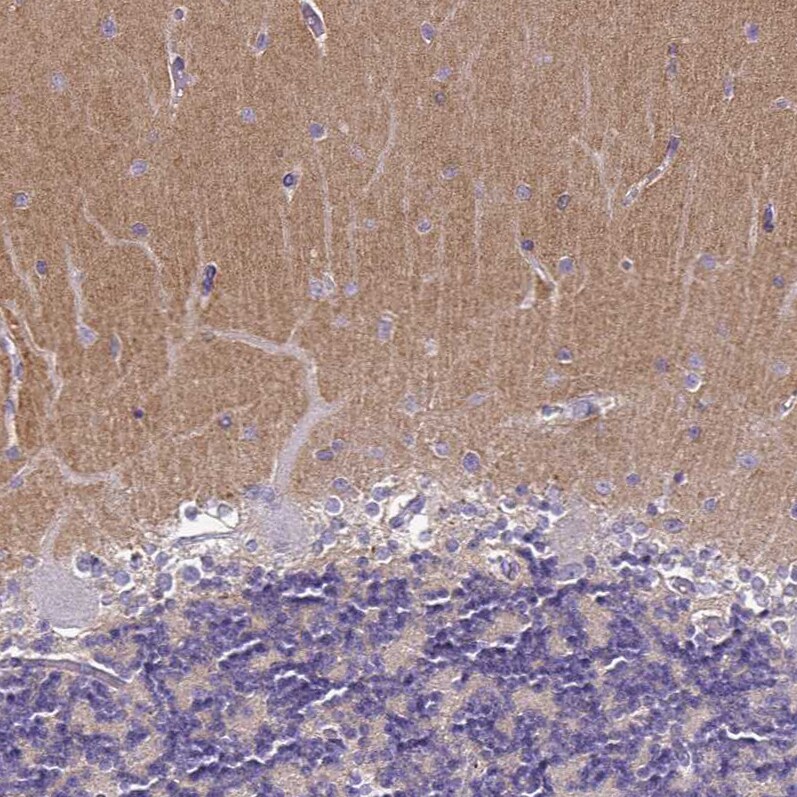 TSPAN7/TM4SF2 Antibody (CL0262) - Azide and BSA Free Immunohistochemistry-Paraffin: TSPAN7/TM4SF2 Antibody [NBP3-44061]