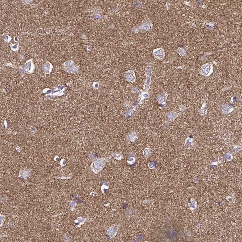 TSPAN7/TM4SF2 Antibody (CL0262) - Azide and BSA Free Immunohistochemistry-Paraffin: TSPAN7/TM4SF2 Antibody [NBP3-44061]