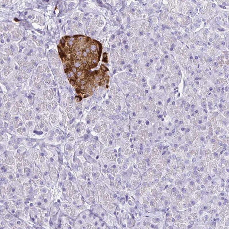TSPAN7/TM4SF2 Antibody (CL0262) - Azide and BSA Free Immunohistochemistry-Paraffin: TSPAN7/TM4SF2 Antibody [NBP3-44061]