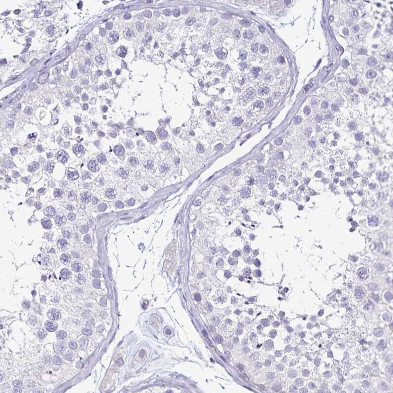 TSPAN7/TM4SF2 Antibody (CL0262) - Azide and BSA Free Immunohistochemistry-Paraffin: TSPAN7/TM4SF2 Antibody [NBP3-44061]