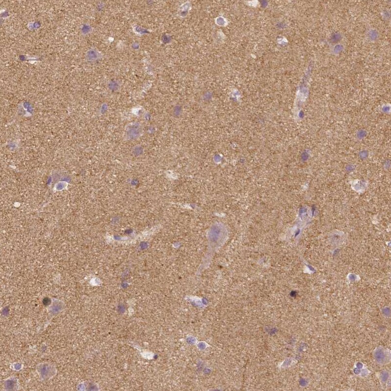 TSPAN7/TM4SF2 Antibody (CL0265) - Azide and BSA Free Immunohistochemistry-Paraffin: TSPAN7/TM4SF2 Antibody [NBP3-44062]