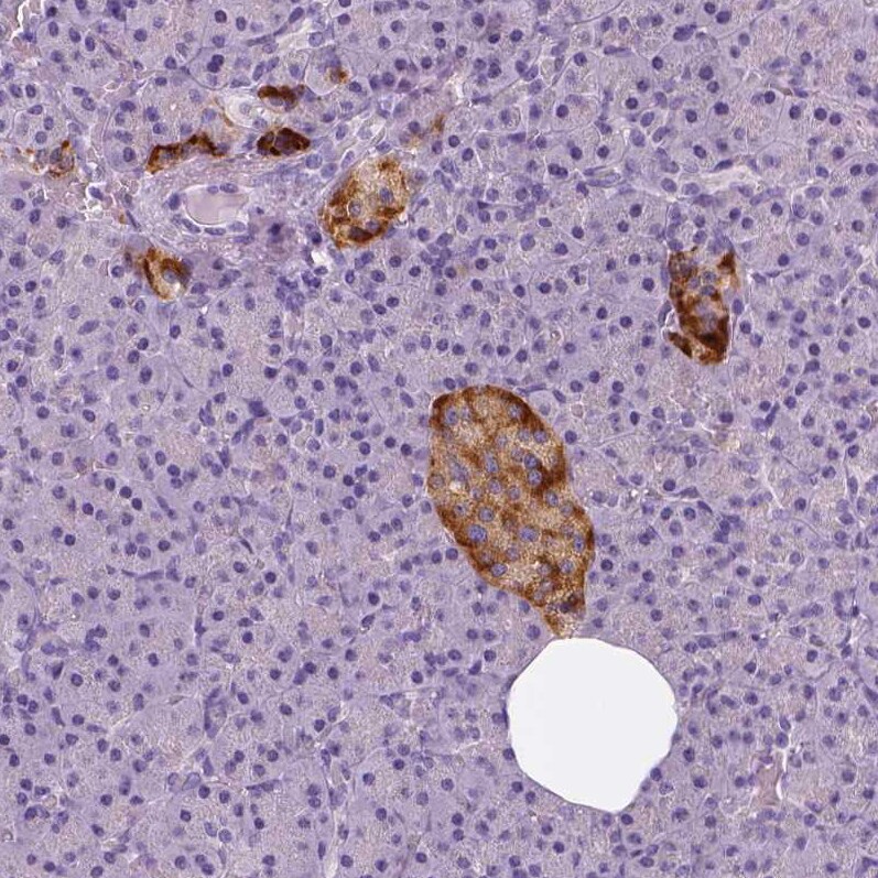 TSPAN7/TM4SF2 Antibody (CL0265) - Azide and BSA Free Immunohistochemistry-Paraffin: TSPAN7/TM4SF2 Antibody [NBP3-44062]