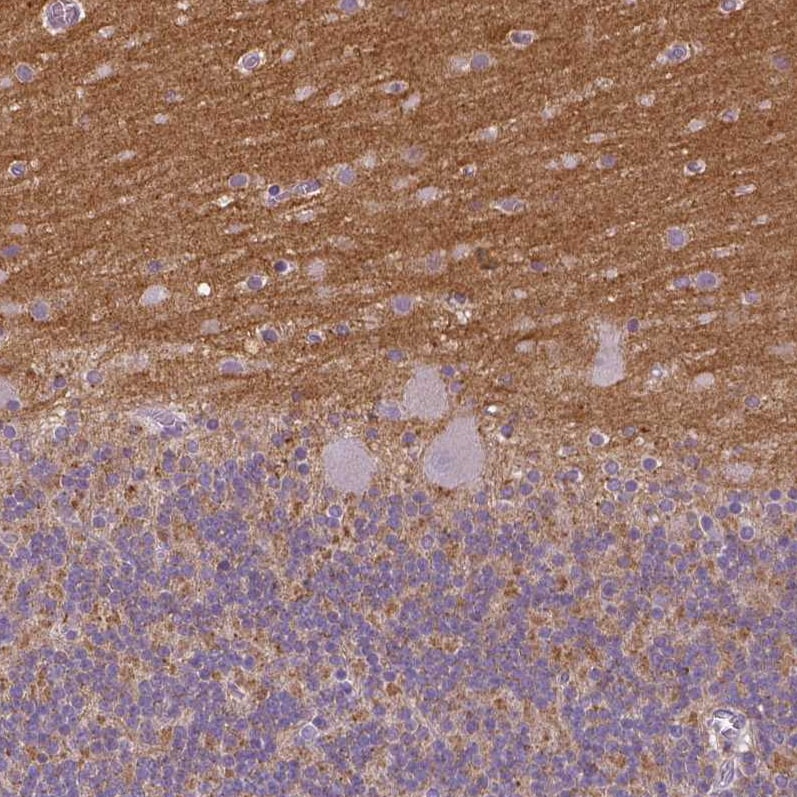 TSPAN7/TM4SF2 Antibody (CL0265) - Azide and BSA Free Immunohistochemistry-Paraffin: TSPAN7/TM4SF2 Antibody [NBP3-44062]