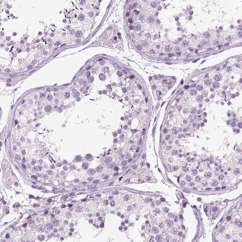 TSPAN7/TM4SF2 Antibody (CL0265) - Azide and BSA Free Immunohistochemistry-Paraffin: TSPAN7/TM4SF2 Antibody [NBP3-44062]