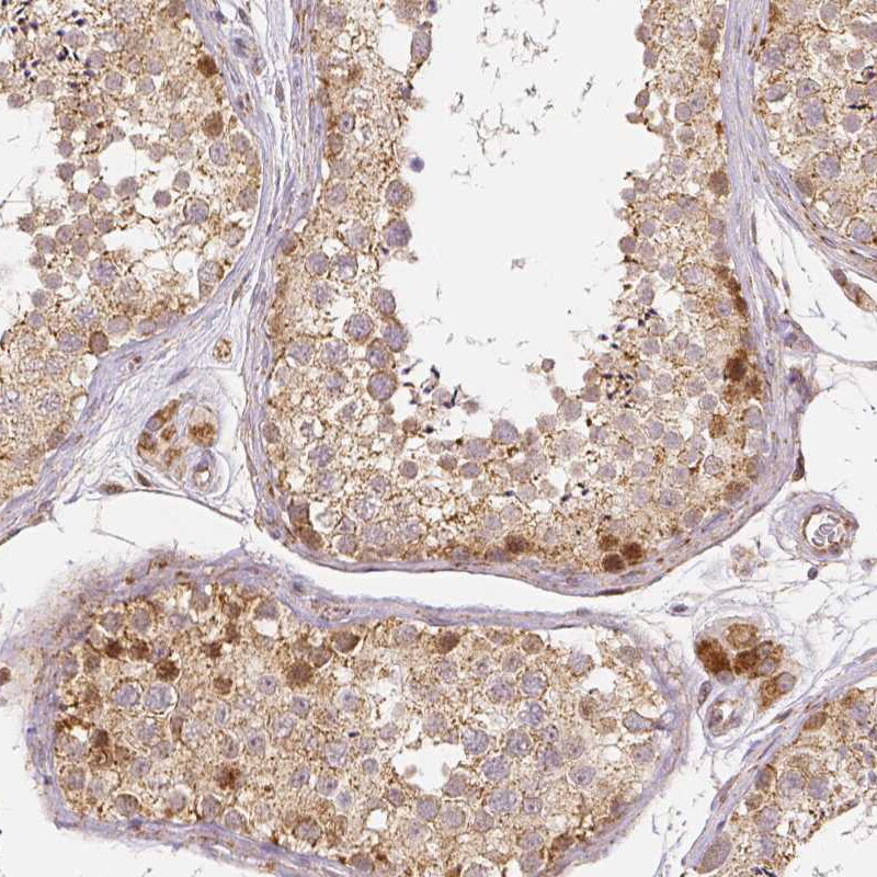 Rhot1 Antibody (CL1083) - Azide and BSA Free Immunohistochemistry-Paraffin: Rhot1 Antibody [NBP3-44063]