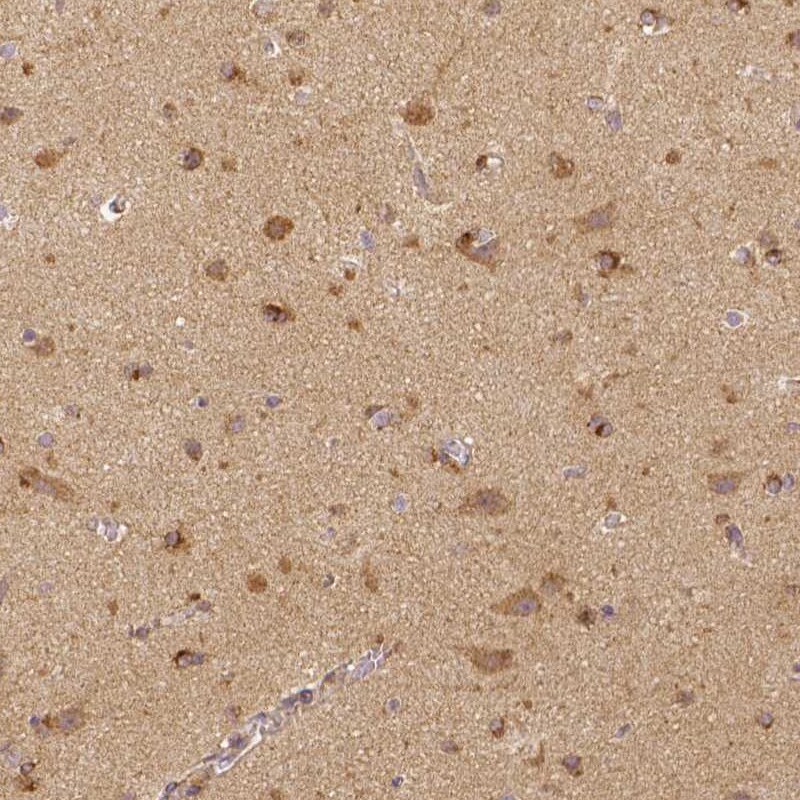 Rhot1 Antibody (CL1095) - Azide and BSA Free Immunohistochemistry-Paraffin: Rhot1 Antibody [NBP3-44064]