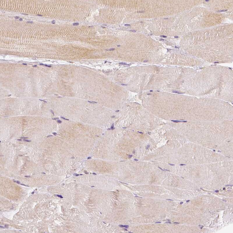 Rhot1 Antibody (CL1095) - Azide and BSA Free Immunohistochemistry-Paraffin: Rhot1 Antibody [NBP3-44064]