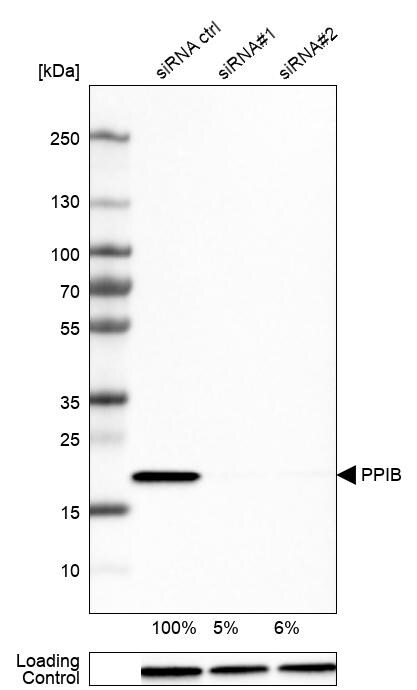 Cyclophilin B Antibody (CL3915) - Azide and BSA Free Western Blot: Cyclophilin B Antibody [NBP3-44067]