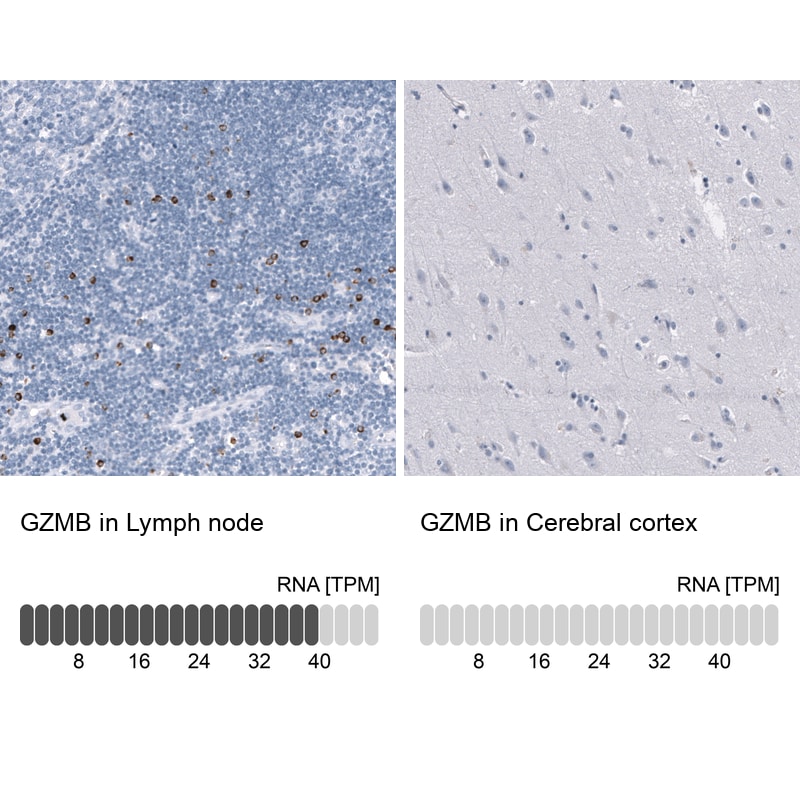 Granzyme B Antibody (CL10662) - Azide and BSA Free Immunohistochemistry-Paraffin: Granzyme B Antibody [NBP3-44068]