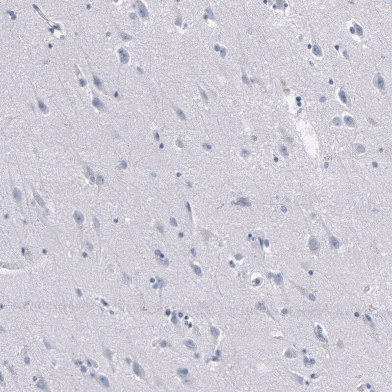 Granzyme B Antibody (CL10662) - Azide and BSA Free Immunohistochemistry-Paraffin: Granzyme B Antibody [NBP3-44068]