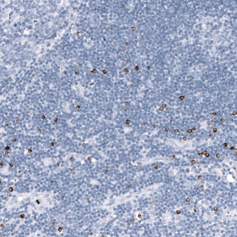 Granzyme B Antibody (CL10662) - Azide and BSA Free Immunohistochemistry-Paraffin: Granzyme B Antibody [NBP3-44068]