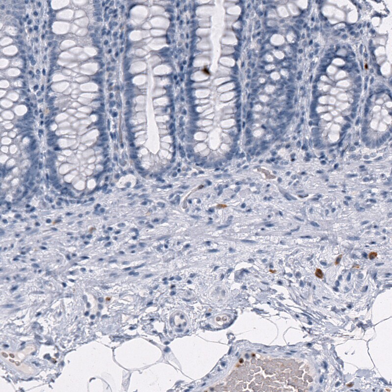 Granzyme B Antibody (CL10662) - Azide and BSA Free Immunohistochemistry-Paraffin: Granzyme B Antibody [NBP3-44068]