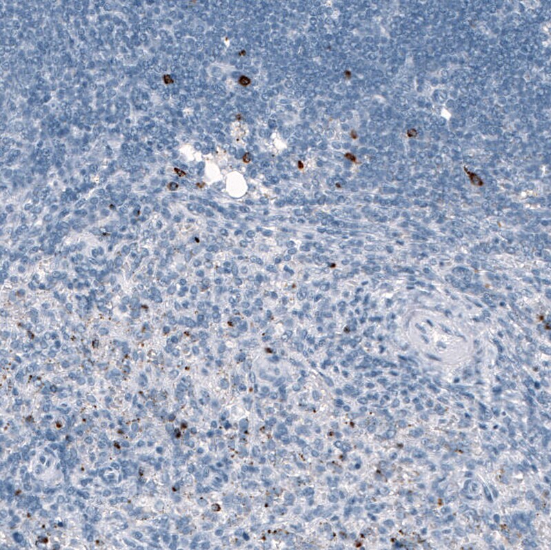 Granzyme B Antibody (CL10662) - Azide and BSA Free Immunohistochemistry-Paraffin: Granzyme B Antibody [NBP3-44068]