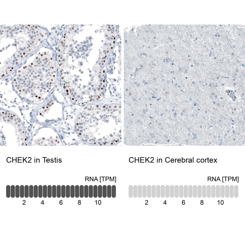 Chk2 Antibody (CL9440) - Azide and BSA Free Immunohistochemistry-Paraffin: Chk2 Antibody [NBP3-44069]