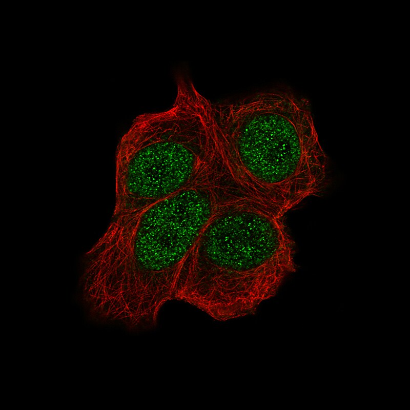 Chk2 Antibody (CL9440) - Azide and BSA Free Immunocytochemistry/ Immunofluorescence: Chk2 Antibody [NBP3-44069]