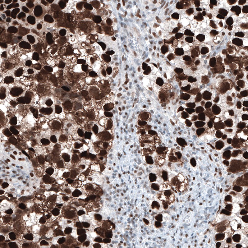 Chk2 Antibody (CL9440) - Azide and BSA Free Immunohistochemistry-Paraffin: Chk2 Antibody [NBP3-44069]