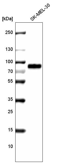 TYRP1 Antibody (CL4923) - Azide and BSA Free Western Blot: TYRP1 Antibody [NBP3-44070]