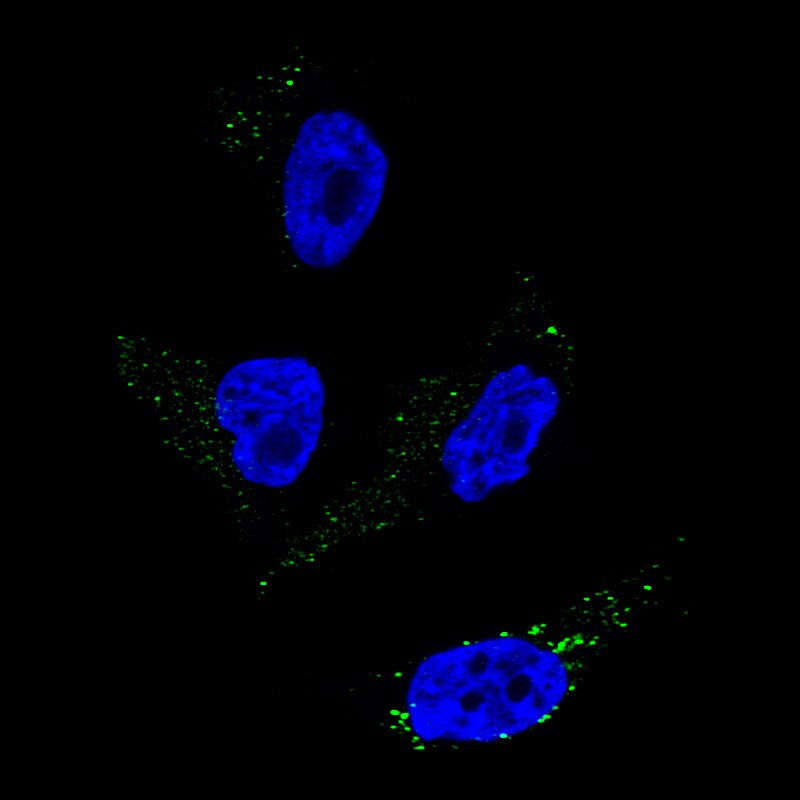 TYRP1 Antibody (CL4923) - Azide and BSA Free Immunocytochemistry/ Immunofluorescence: TYRP1 Antibody [NBP3-44070]