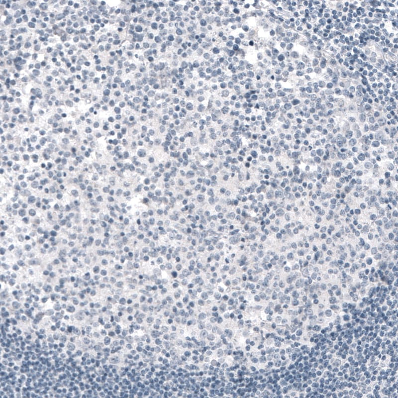TYRP1 Antibody (CL4923) - Azide and BSA Free Immunohistochemistry-Paraffin: TYRP1 Antibody [NBP3-44070]
