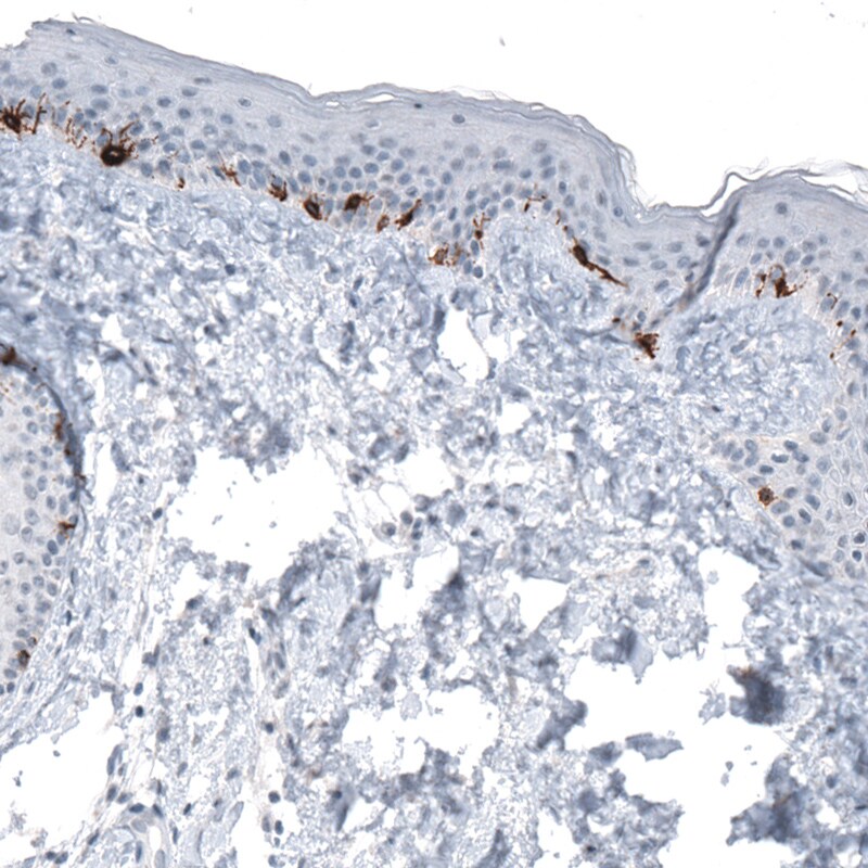 TYRP1 Antibody (CL4923) - Azide and BSA Free Immunohistochemistry-Paraffin: TYRP1 Antibody [NBP3-44070]