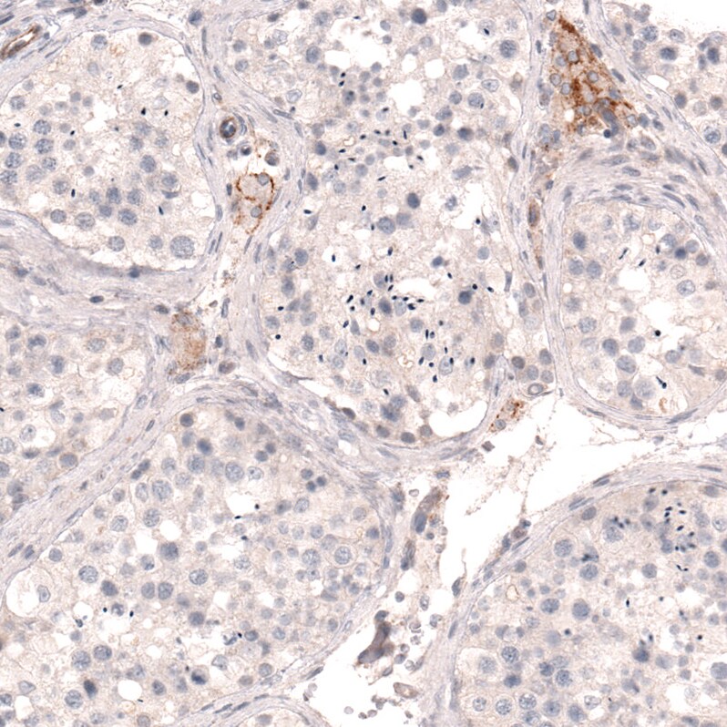 THSD7A Antibody (CL3779) - Azide and BSA Free Immunohistochemistry-Paraffin: THSD7A Antibody [NBP3-44072]