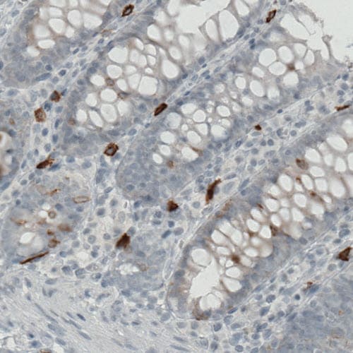 CD117/c-kit Antibody (CL1667) - Azide and BSA Free Immunohistochemistry-Paraffin: CD117/c-kit Antibody [NBP3-44073]