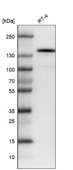 CD117/c-kit Antibody (CL1656) - Azide and BSA Free Western Blot: CD117/c-kit Antibody [NBP3-44074]