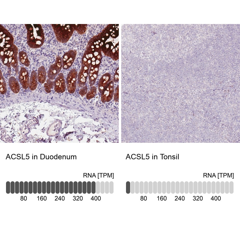 ACSL5 Antibody (CL0275) - Azide and BSA Free Immunohistochemistry-Paraffin: ACSL5 Antibody [NBP3-44076]