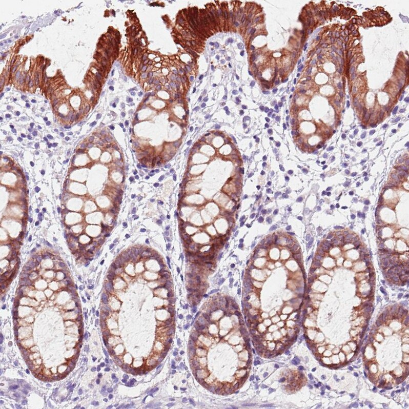 ACSL5 Antibody (CL0275) - Azide and BSA Free Immunohistochemistry-Paraffin: ACSL5 Antibody [NBP3-44076]