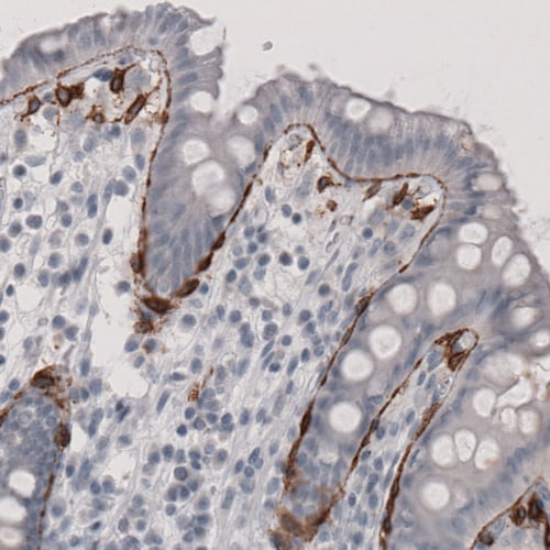 Coagulation Factor III/Tissue Factor Antibody (CL3805) - Azide and BSA Free Immunohistochemistry-Paraffin: Coagulation Factor III/Tissue Factor Antibody [NBP3-44077]