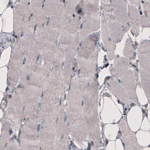 Coagulation Factor III/Tissue Factor Antibody (CL3805) - Azide and BSA Free Immunohistochemistry-Paraffin: Coagulation Factor III/Tissue Factor Antibody [NBP3-44077]