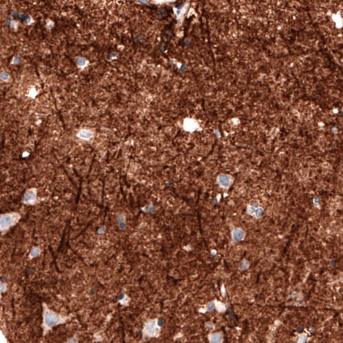 Coagulation Factor III/Tissue Factor Antibody (CL3807) - Azide and BSA Free Immunohistochemistry-Paraffin: Coagulation Factor III/Tissue Factor Antibody [NBP3-44078]