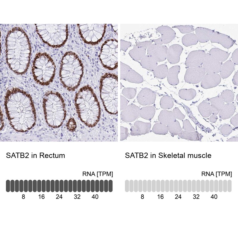 SATB2 Antibody (CL0276) - Azide and BSA Free Immunohistochemistry-Paraffin: SATB2 Antibody [NBP3-44079]
