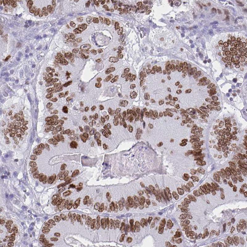 SATB2 Antibody (CL0276) - Azide and BSA Free Immunohistochemistry-Paraffin: SATB2 Antibody [NBP3-44079]