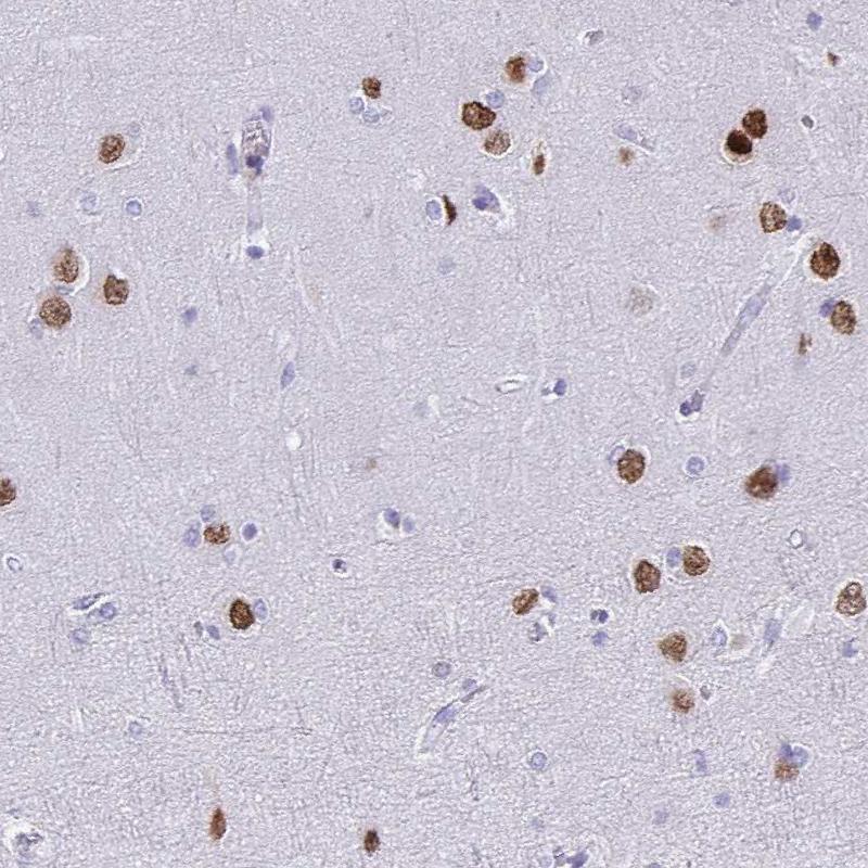SATB2 Antibody (CL0276) - Azide and BSA Free Immunohistochemistry-Paraffin: SATB2 Antibody [NBP3-44079]