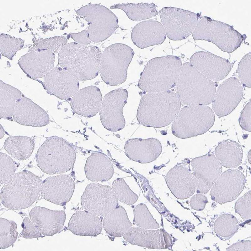 SATB2 Antibody (CL0276) - Azide and BSA Free Immunohistochemistry-Paraffin: SATB2 Antibody [NBP3-44079]